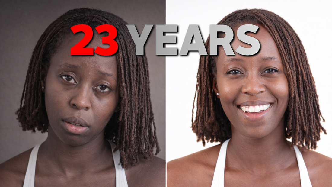 What 23 Years of Steroid Creams Did to My Body