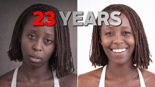 What 23 Years of Steroid Creams Did to My Body