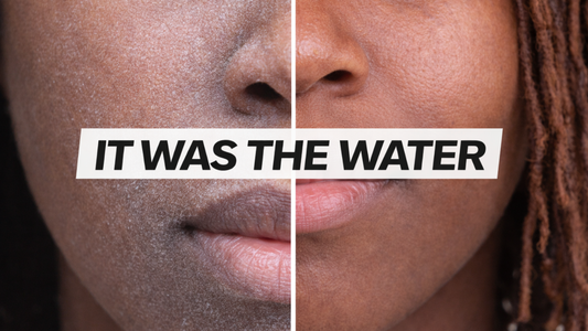 What Distilled Water Did to My Skin in 30 Days